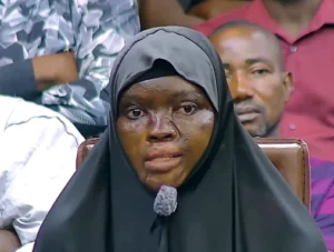 JUST IN: My Ex-husband Poured Acid On My Face I Shouted & Searched For Water;He Poured More Acid On Me –Anioba