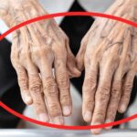 5 Reasons Why Some People Have Visible Veins Showing Through Their Skin