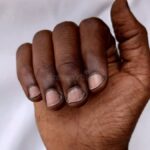 4 Reasons Why Your Nails May Turn Black That Most People Don't Know