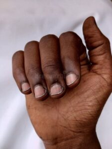 4 Reasons Why Your Nails May Turn Black That Most People Don’t Know