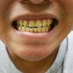 4 Daily Mistakes That Can Make Your Teeth Turn Yellow Without You Realising