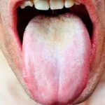 How Long Can HIV Hide In The Body Without Any Symptoms? The Answer Might Shock You