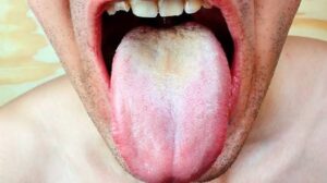 How Long Can HIV Hide In The Body Without Any Symptoms? The Answer Might Shock You