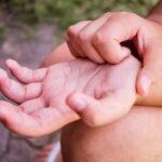 5 Possible Causes Of An Itchy Palm You Should Know
