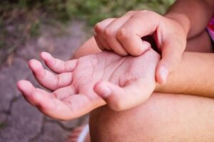 5 Possible Causes Of An Itchy Palm You Should Know
