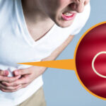 3 Foods People Believe Help Fight Intestinal Worms And What Actually Works
